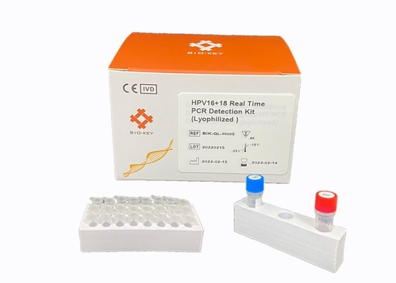 実時間HPV PCRのキットのDectect危険度が高いGenotyping HPVのウイルスのTaqmanの調査の試金